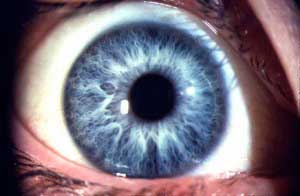 blueiris