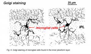 microglia1