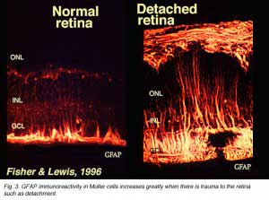GFAP-IR