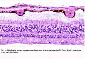 Hagerman.Fig14
