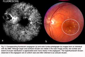 Hagerman.Fig5