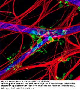 Immunomicroglia