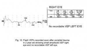 VEPFig10