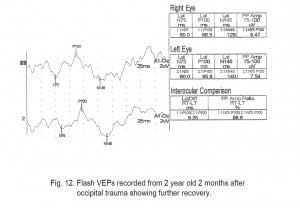 VEPFig12