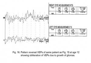 VEPFig16