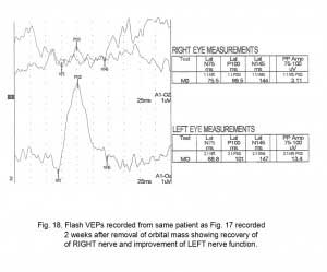 VEPFig18