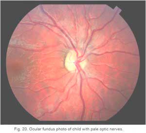 VEPFig20