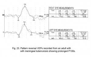 VEPFig23