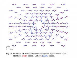 VEPFig25