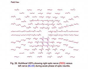 VEPFig26