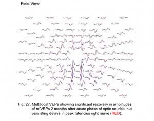 VEPFig27
