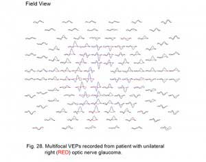 VEPFig28