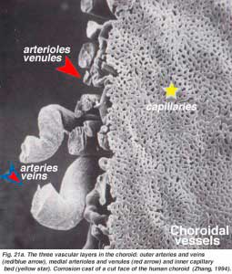 choroid