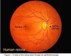 huretina