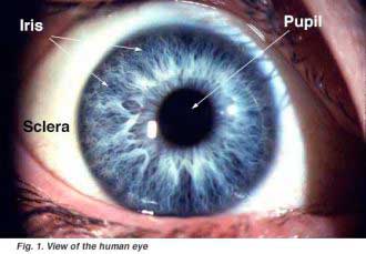 pupil1