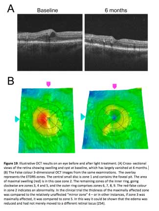 Figure19
