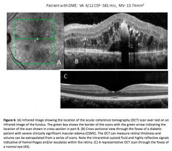 Figure6